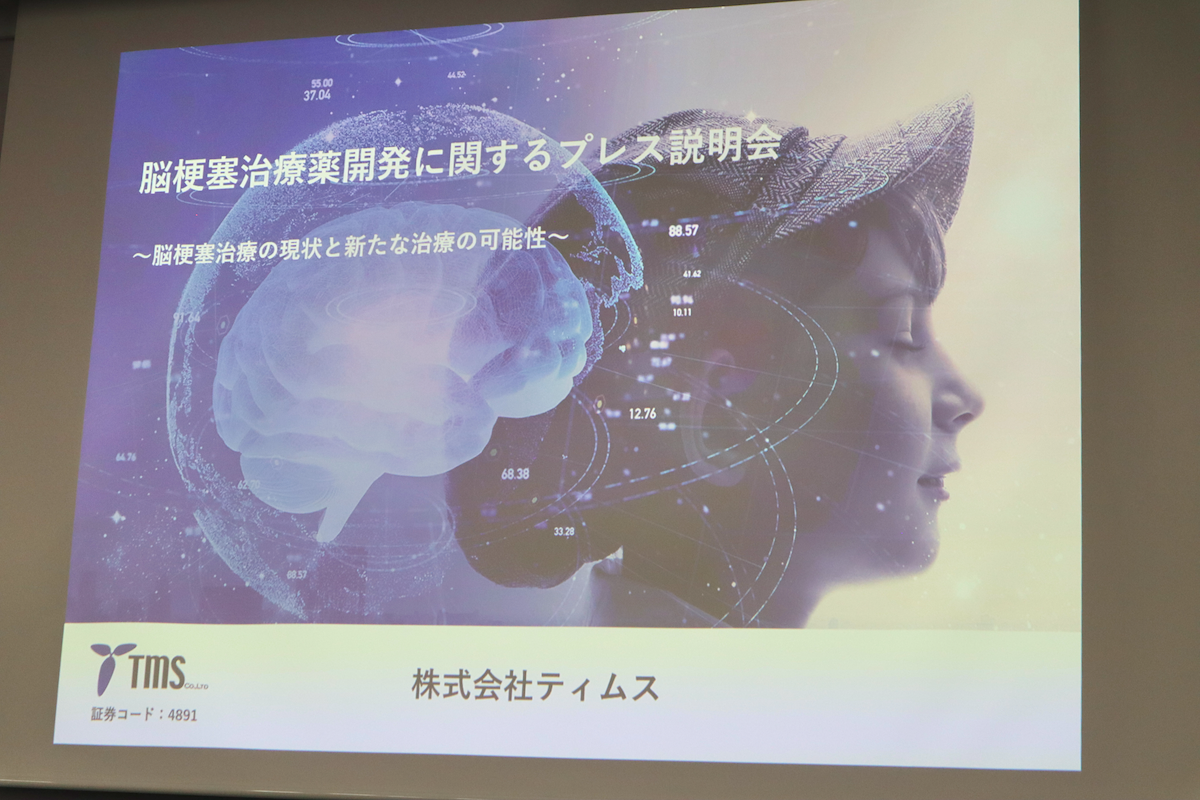 脳梗塞治療に新たな選択肢！ 創薬ベンチャーが研究開発する「TMS-007